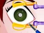 Дени: хирургия глаза (онлайн)
